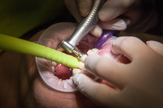 Se incrementa la mala higiene bucal en México, 90% tiene problemas dentales