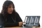 Desarrolla IPN sistema con Inteligencia Artificial para priorizar casos urgentes en cáncer de mama